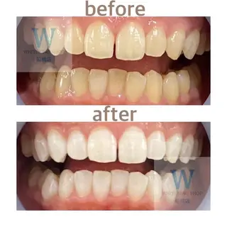 ホワイトニング ショップ船橋店🦷のエステ・リラクイメージ