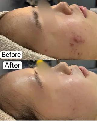 Belle原宿所属・佐藤 加奈のエステ・リラクイメージ