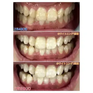 M渋谷 ホワイトニングのエステ・リラクイメージ