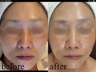 Salon de Bis所属・サロン ド ビス 髙橋美月のエステ・リラクイメージ