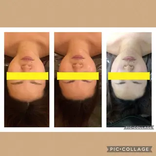 小顔🌼💕肌質改善 SalonBelleのエステ・リラクイメージ