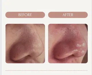 ピーリング＆脱毛 maoのエステ・リラクイメージ