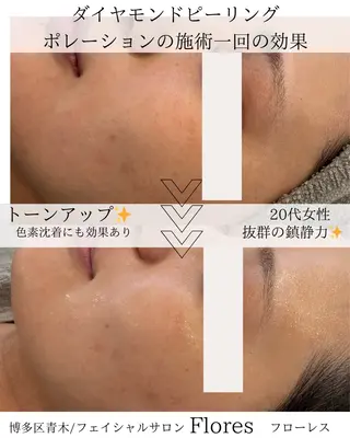 Flores所属・Flores- フローレスのエステ・リラクイメージ