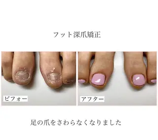 ネイル ネイルサロン アリュームのネイルデザイン