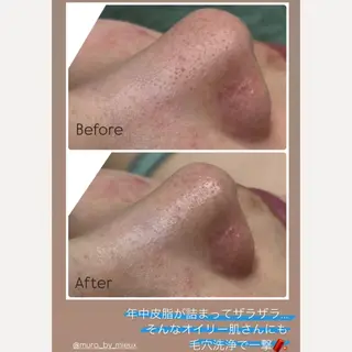 美肌脱毛サロン muroのエステ・リラクイメージ