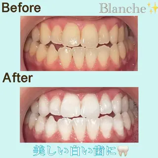 Blanche 心斎橋のその他イメージ