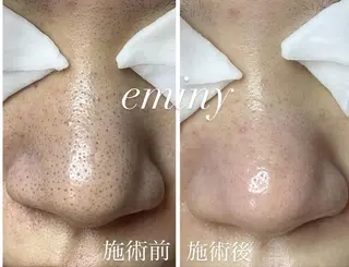 EMINY （エステティシャン）のエステ・リラクイメージ