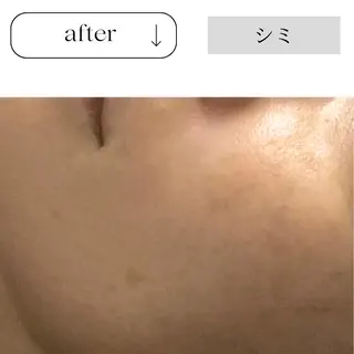 beauty CHOOSEのエステ・リラクイメージ