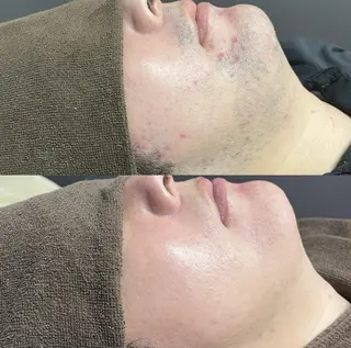 Lilyboo 多田のエステ・リラクイメージ