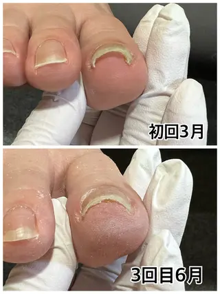 ネイル 巻き爪補正店 堺東店のネイルデザイン