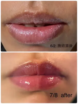 Raviy 【痩身専門・肌管理】のエステ・リラクイメージ