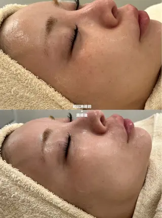 エステサロンTug高知駅前店所属・Tug 高知駅前店/ NANAMI🌐のエステ・リラクイメージ