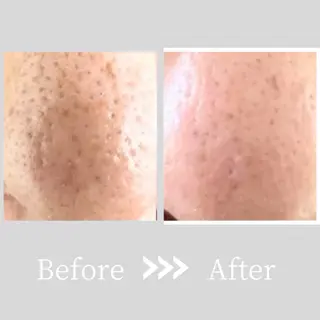 小顔・ツルツル素肌 ハリステリアのエステ・リラクイメージ