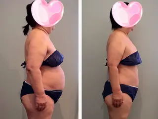 Bodymakesalon Uni所属・ダイエットはお任せ 3ヶ月－5～10kgのエステ・リラクイメージ