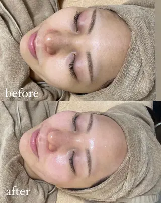 エステサロン Mi-mi.iのエステ・リラクイメージ