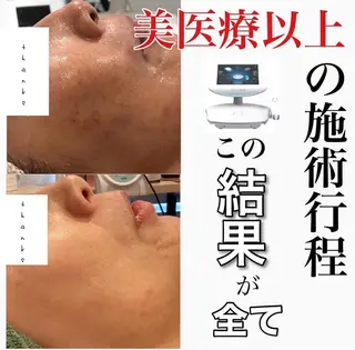 Lumiere despoirのエステ・リラクイメージ