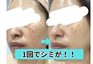 エステ♡ Eden Yuriのエステ・リラクイメージ