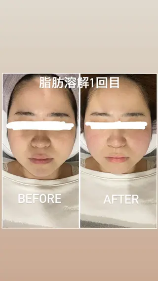 毛穴洗浄・痩身・脱毛 /アルカンジュのエステ・リラクイメージ