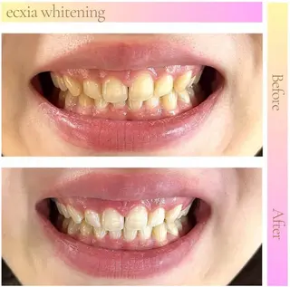 エクシアホワイト 伊勢崎店のその他イメージ