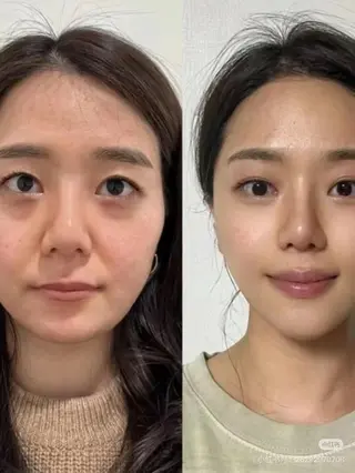 ネイル aliaハイフ&水光ジェットサロン所属・aliaハーブ水光店 エステティシャン募集のエステ・リラクイメージ