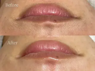 MilleTendresses所属・本町オールハンド リラク/女性専用💐のエステ・リラクイメージ