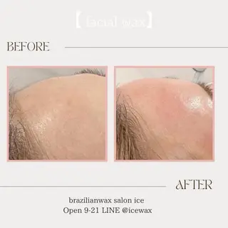 アイブロウ ワックス脱毛専門店 ICE北千住のエステ・リラクイメージ
