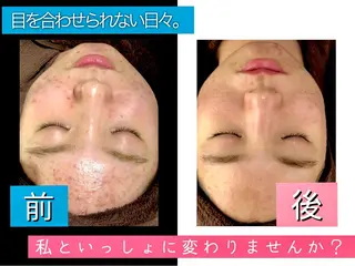 セミロング カラー パーマ ヘアアレンジ メンズ キッズ ネイル マツエク・マツパ 金の糸脱毛 産毛ケア専門のエステ・リラクイメージ