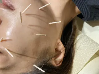 むくみたるみ専門☆ 美容鍼・小顔矯正のエステ・リラクイメージ
