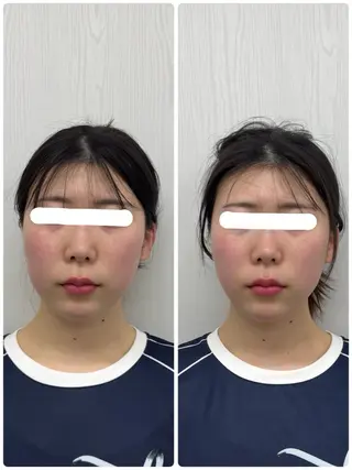 美容鍼×小顔矯正 ×美容整体　浜川泰仁のエステ・リラクイメージ