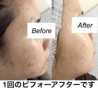 セミロング カラー パーマ ヘアアレンジ キッズ ネイル マツエク・マツパ 都度払い肌質改善 &脱毛Blancheのエステ・リラクイメージ