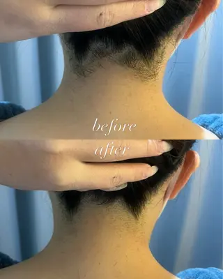 うなじ脱毛/美肌脱毛 LABELのエステ・リラクイメージ