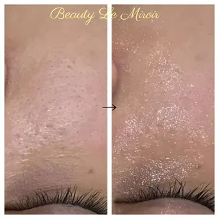 ビューティー ミロワールのエステ・リラクイメージ