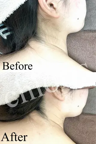 川越 光脱毛/ワックス脱毛のエステ・リラクイメージ