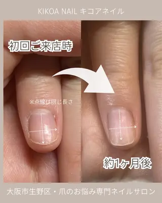 ネイル KIKOA NAIL キコアネイルのネイルデザイン