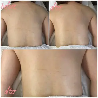 酒井 瑠未のエステ・リラクイメージ