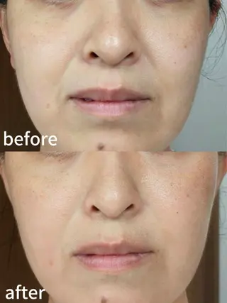 アピタ千代田橋店 ポーラ 楊のエステ・リラクイメージ