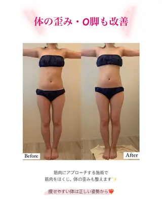 産後ダイエット−9㎏ Pourvous結衣のエステ・リラクイメージ