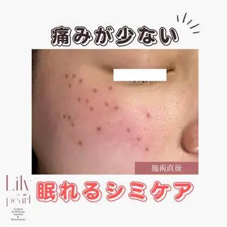 最新シミケアLily de pearlのエステ・リラクイメージ