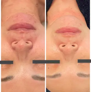 Lumiere by SERIKA.所属・稲角 芹香のエステ・リラクイメージ