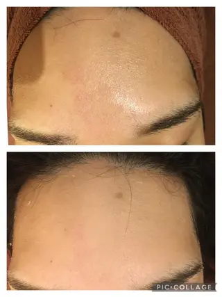 ロング カラー パーマ ヘアアレンジ メンズ キッズ ネイル マツエク・マツパ アイブロウ 3か月で肌革命👼 ニキビ専門店💫のエステ・リラクイメージ