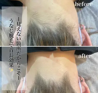 脱毛専門サロンElixir所属・脱毛専門サロン ELIXIR館林店のエステ・リラクイメージ