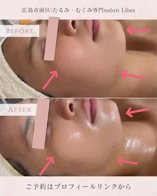 Lilas所属・痩身・リンパ専門 Lilas広島駅前店のその他イメージ