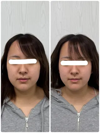 美容鍼×小顔矯正 ×美容整体　浜川泰仁のエステ・リラクイメージ