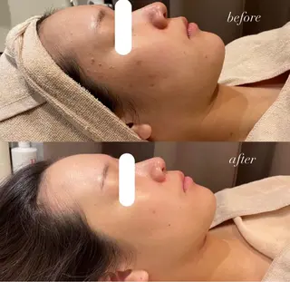 mumu 野々市若松店所属・mumu Rちゃんのエステ・リラクイメージ