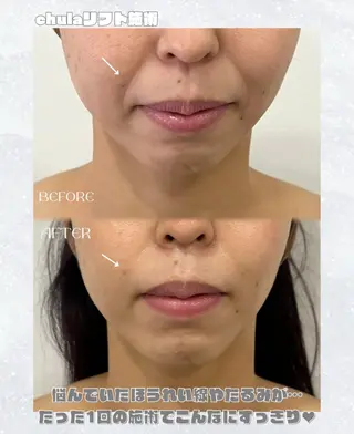 chulanail所属・natsumi .のエステ・リラクイメージ