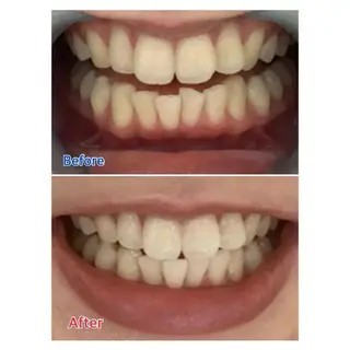 M渋谷 ホワイトニングのエステ・リラクイメージ