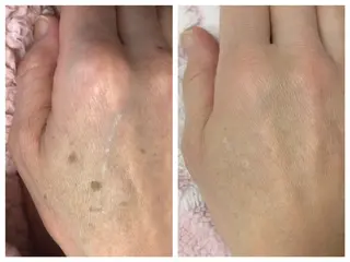 顔専門エステ プリエールビューティのエステ・リラクイメージ