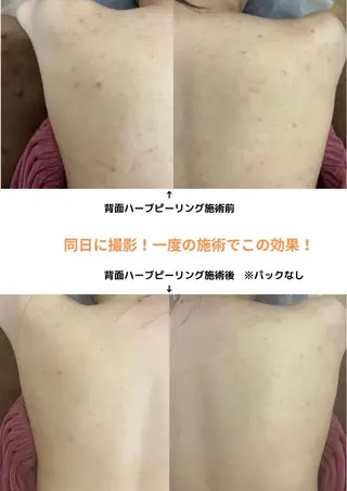 ベルーテ エッセンスのエステ・リラクイメージ