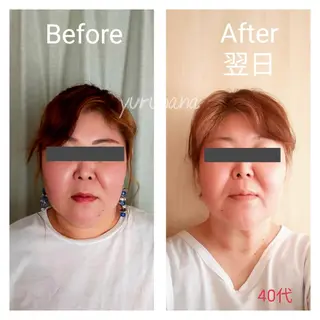 小顔矯正&足つぼサロン　yuruhana所属・小顔矯正&足つぼ yuruhanaのエステ・リラクイメージ