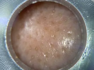 シミケア専門店 &More所属・シミケア専門店 &Moreのエステ・リラクイメージ